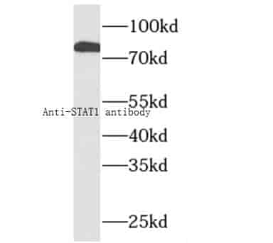 Anti-STAT1 antibody - Click Image to Close